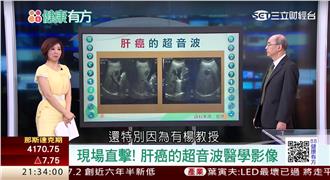 真的嗎？ABCDE肝炎都治得好？！