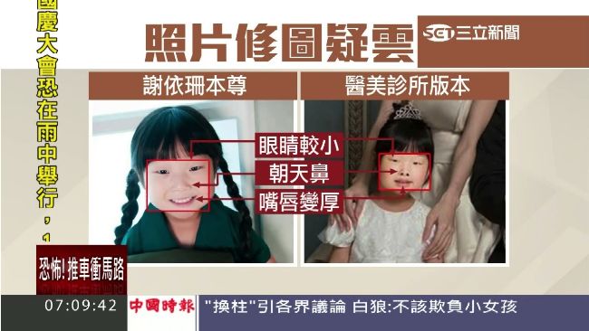 女模泣醫美照毀星途　女孩圖修更大！