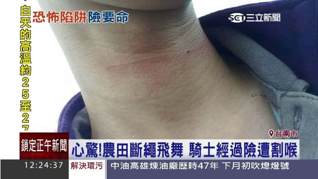 驚！農田斷繩飛舞　騎士經過險遭割喉
