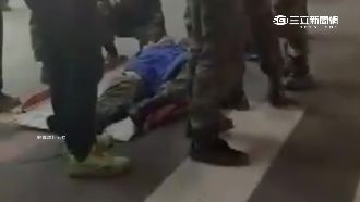 運裝備遭電擊　士兵全身50%灼傷