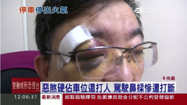 衰！遇惡煞硬佔車位　駕駛遭打斷鼻樑