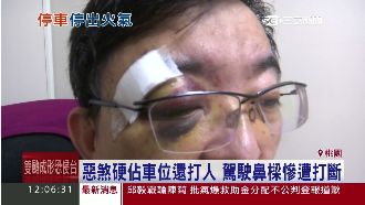 衰！遇惡煞硬佔車位　駕駛遭打斷鼻樑