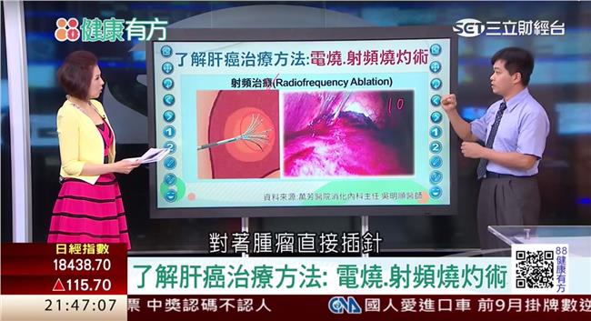 食安害癌症時鐘快轉？終結肝癌大揭密