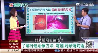 食安害癌症時鐘快轉？終結肝癌大揭密