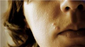 哇潮,痘痘,防曬,洗澡,冰淇淋▲圖／攝影者Caitlin Regan, flickr CC License
https://www.flickr.com/photos/caitlinator/2739337639/in/photolist-5b4PDi-G51d5-dnyM5-7G1AVM-xcqFE-5xme3N-wXNAg-7V9K4L-5BxySH-chr9Hh-92Uy1g-92Uxnz-5zoes5-92Uywz-dLEWKG-7uqeJ3-7qQ9UU-9VykpB-7gwWaQ-75WTng-7vQaGd-5fagvk-5Pv7Me-vEus-5mhxvS-5tnerh-7G7SfH-9HrTJ8-a8CA7A-6sQor3-aYoFYg-e9VKP2-ea2qAw-ea2qyE-ea2qwU-ea2qv9-e9VKCa-e9VKzF-ea2qnU-ea2qkU-ea2qjA-e9VKrH-e9VKpF-e9VKn6-e9VKke-e9VKhK-e9VKg8-ea2q6o-ea2q4q-ea2q2C