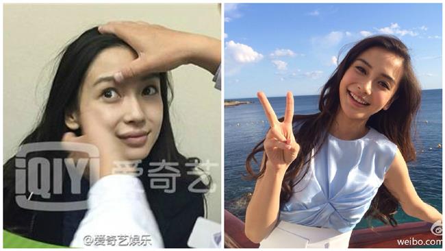 楊穎沒整型　網友轟：當我們瞎了嗎？