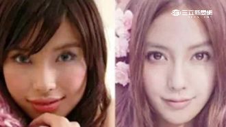 Baby零整型？遭質疑X光片非本人