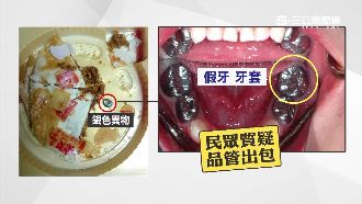 喜餅驚見「銀色假牙」　新人臉上無光
