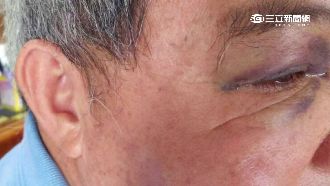 不滿廣告被撕　3房仲毆65歲老志工