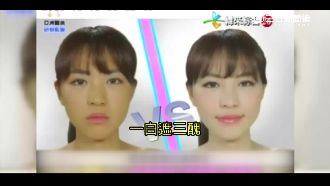 3秒美白騙很大　亞洲醫美廣告誆民眾