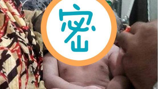 奇蹟般降世！女嬰生下來就有「雙頭」