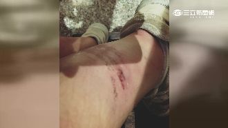 摔車學生控車行冷處理　業主怒提告