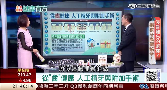 人工植牙有學問！植體、牙冠怎麼選？