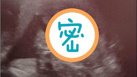 超音波影像糊　腹中胎兒用這個報平安