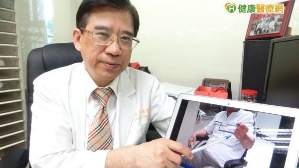 中風後注射肉毒桿菌素　癱女抬手吃飯