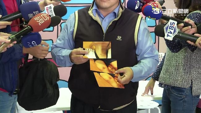 男童慘遭多人踢虐　知名安親班疑隱匿