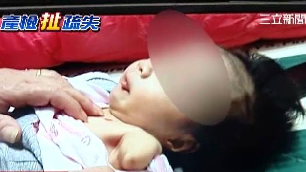 讚！2歲單腿天使跨出第一步感動爸媽