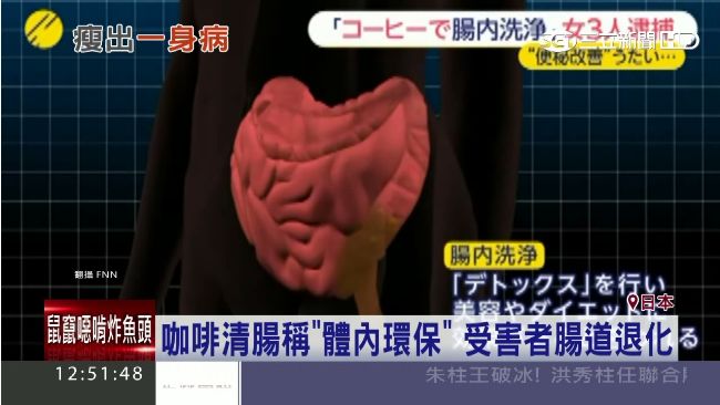 日本盛行咖啡清腸法　恐失去排便能力