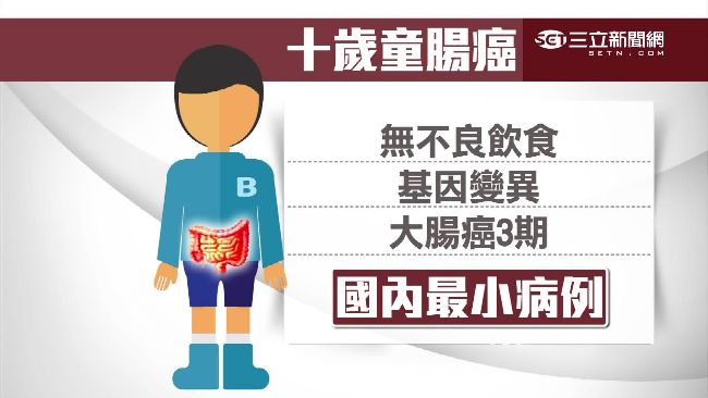 10歲男童腸癌3期　成全台最小病例