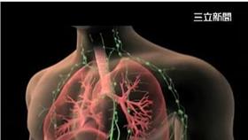 肺癌,癌症 （圖／資料照）