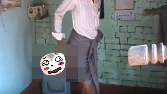 背部長出這東西　他從小被當魔鬼