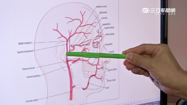 咳嗽太猛眼內出血　中年男一度失明