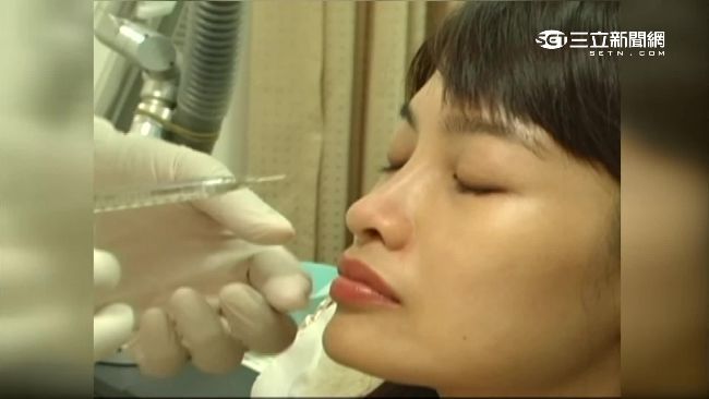 自體脂肪打臉部　施打不當恐致失明