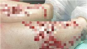 刺青-圖／翻攝自Yann Brenyak臉書