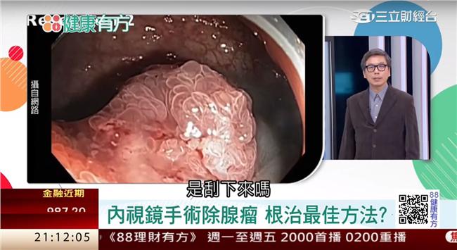 擒癌先擒王　褐藻抑制癌幹細胞？