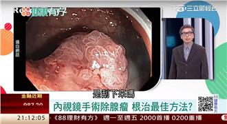 擒癌先擒王　褐藻抑制癌幹細胞？