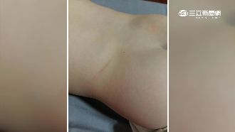 處罰過當？幼園老師抽打4歲男童腰臀