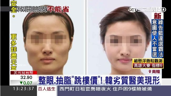 半價！南韓整形變路邊攤「整壞不賠」