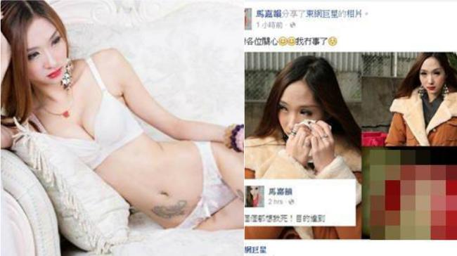 C奶女模裸照外流　崩潰公布自殘照