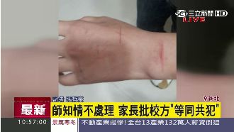 制止惡作劇被霸凌　國一女美工刀割手