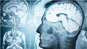 人腦－示意圖／達志影像