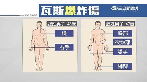 登山客煮水突「瓦斯氣爆」　炸傷兩休假警