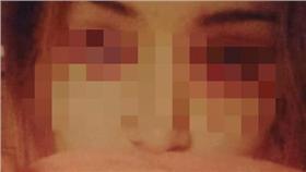 血淚怪病－圖／翻攝自《太陽報》