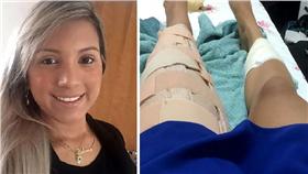 ▲巴西女律師中槍。（圖／翻攝自《Globo.com》網站）
http://g1.globo.com/rn/rio-grande-do-norte/noticia/2016/01/o-silicone-salvou-minha-vida-diz-advogada-vitima-de-atentado-em-natal.html