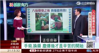 如活剝皮！換藥燒燙傷患的「地獄」