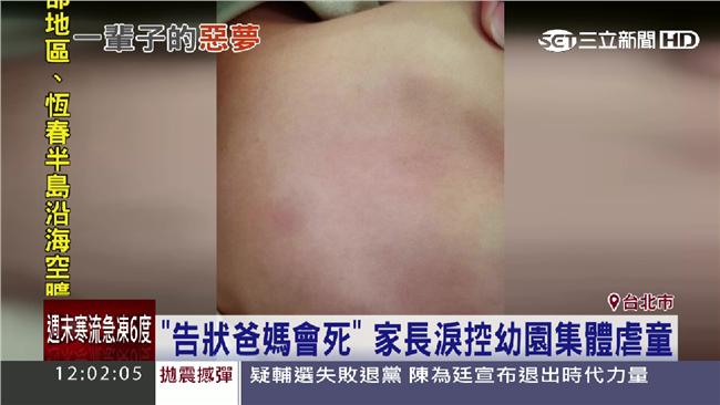 驚爆幼兒園虐童　打、掐、踹樣樣來