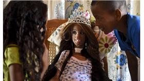 女孩早衰症 圖/翻攝自每日星報