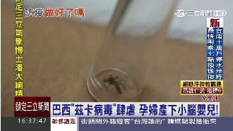 巴西茲卡病毒肆虐　孕婦產下小腦嬰兒