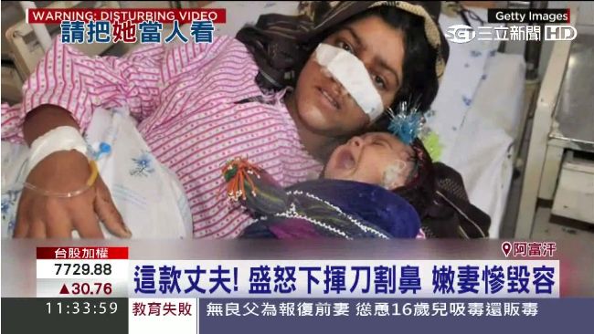 怒！丈夫盛怒下揮刀割鼻　嫩妻慘毀容