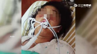 疑同居人施暴！少女赤裸癱瘓送醫