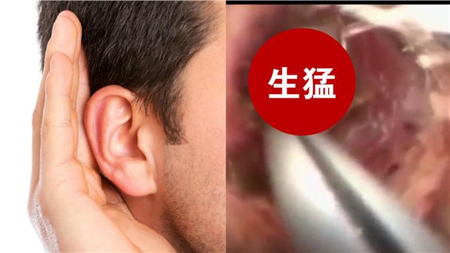 生猛活蟲入侵！一股腦往他耳朵深處竄