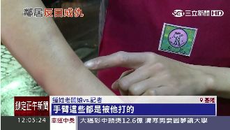 疑推招牌起衝突　陸籍老闆娘遭毆打