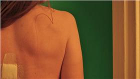 皮膚,背部 ▲圖／攝影者Traci Lawson, flickr CC License (https://www.flickr.com/photos/tracilawson/3232505559/)