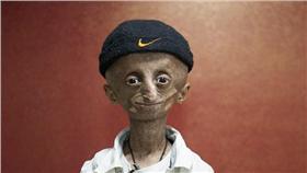 早衰症印度少年尼哈
翻攝自每日郵報
http://www.dailymail.co.uk/health/article-3422880/Teenager-trapped-body-pensioner-s-ageing-EIGHT-times-faster-normal-defies-doctors-reach-15th-birthday.html