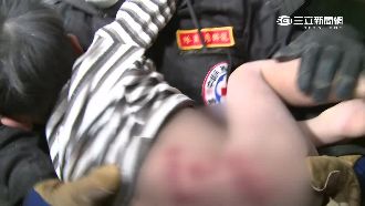 救難人員花6小時　保住3歲童的手臂