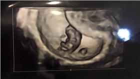 黃鐙輝,萁萁,懷孕,黃立成,度蜜月,搞笑藝人